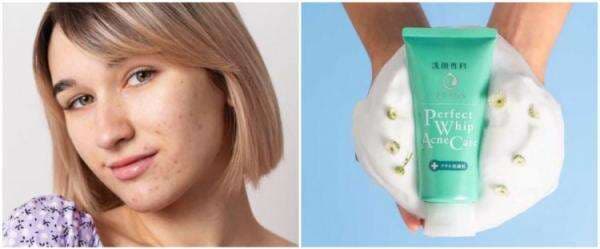 7 Skincare lokal untuk hilangkan bekas jerawat, di bawah Rp 100 ribu 7 Skincare lokal untuk hilangkan bekas jerawat, di bawah Rp 100 ribu