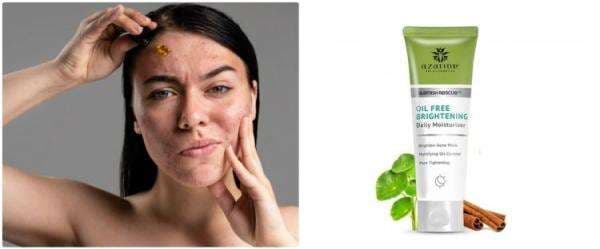 7 Skincare non-comedogenic harga di bawah Rp 150 ribu 7 Skincare non-comedogenic harga di bawah Rp 150 ribu