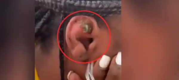 Video Seekor Kepiting yang Terjebak di Telinga Wanita Saat Snorkeling Jadi Viral