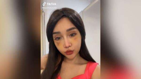 Lucinta Luna Unboxing Wajah Hasil Oplas, Disebut Mirip Artis K-Pop Wonyoung Lucinta Luna Unboxing Wajah Hasil Oplas, Disebut Mirip Artis K-Pop Wonyoung
