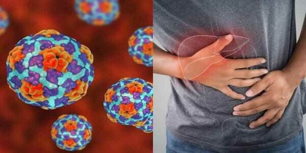 Fakta-fakta Virus Hepatitis Misterius: Gejala, Mutasi dan Awal Mula