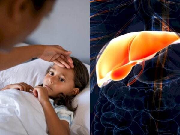 Waspada, Hepatitis Misterius Mengintai Anak-Anak, Kenali Cara Penularannya!