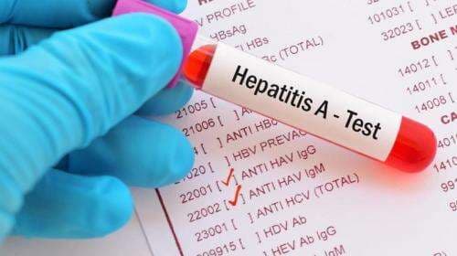 Waspadai Hepatitis Misterius pada Anak, Ini Penyebab dan Cara Mencegahnya