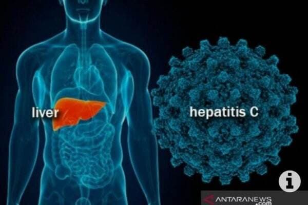 Biaya Perawatan Pasien Hepatitis Akut Ditanggung Pemerintah
