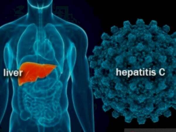 Ancaman Hepatitis Misterius pada Anak-anak, Ini 5 Jenis Hepatitis yang Perlu Diwaspadai