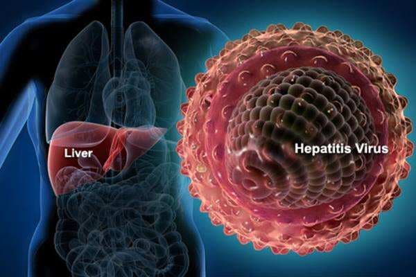 Kenali 5 Jenis Hepatitis A, B, C, D dan E, dari Penyebab, Gejala, dan Penyembuhannya Kenali 5 Jenis Hepatitis A, B, C, D dan E, dari Penyebab, Gejala, dan Penyembuhannya