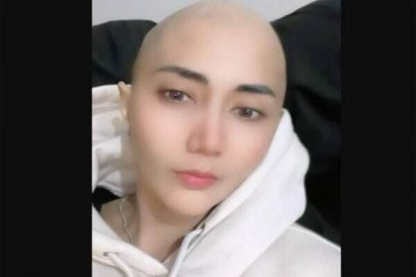 Aida Saskia Jalani Kemoterapi Ketiga Kanker Payudara, Bagian Dada Terpasang Selang