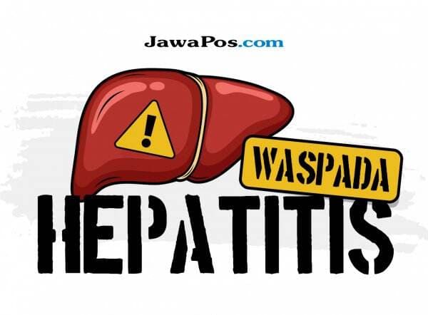 Kemenkes Sebut Kemungkinan Hepatitis Akut Jadi Pandemi Relatif Kecil