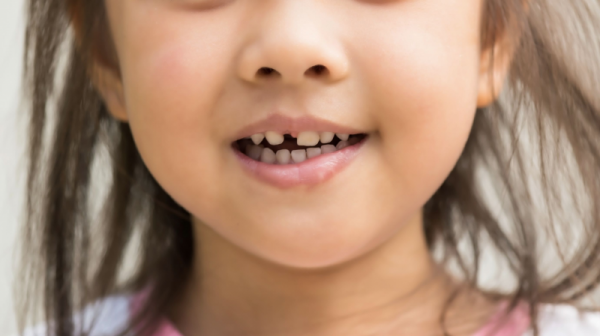 Cara Meredakan Keluhan Akibat Tumbuh Gigi Pada Anak