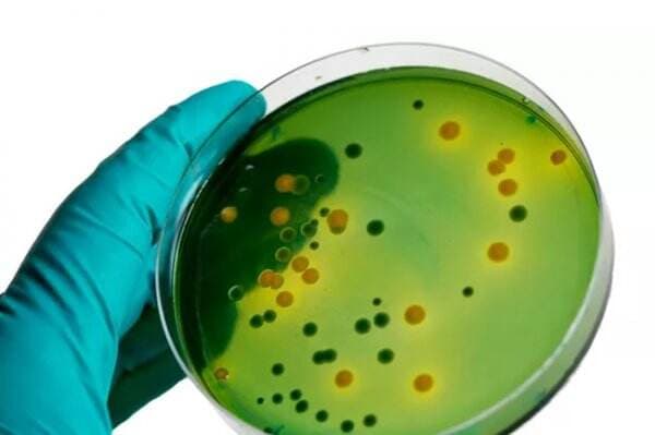 Wabah Listeria Menyerang AS, 22 Orang Dirawat 1 Tewas