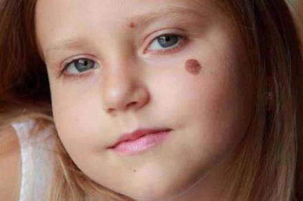 5 Tanda Lahir Orang Beruntung, Banyak Orang Tak Menyadarinya 5 Tanda Lahir Orang Beruntung, Banyak Orang Tak Menyadarinya