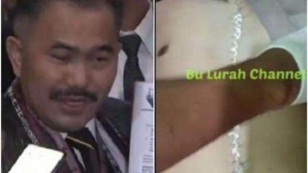 Sebut Psikopat, Kuasa Hukum Keluarga Ungkap Luka-luka Brigadir J: Remuk dan Hancur Sebut Psikopat, Kuasa Hukum Keluarga Ungkap Luka-luka Brigadir J: Remuk dan Hancur