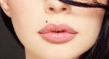 Bahaya Kah Tahi Lalat yang Ditumbuhi Rambut? Ini Penjelasan Dokter Bahaya Kah Tahi Lalat yang Ditumbuhi Rambut? Ini Penjelasan Dokter