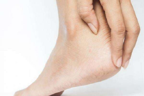 Kulit Kaki Kering? Berikut Penyebab dan Cara Mengatasinya Dengan Mudah Kulit Kaki Kering? Berikut Penyebab dan Cara Mengatasinya Dengan Mudah