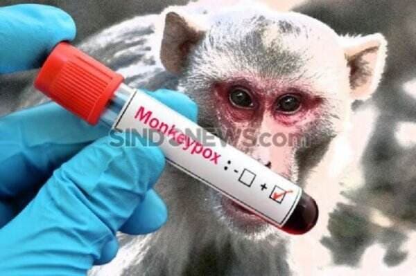 17 Kasus Suspek Cacar Monyet Ditemukan, Masyarakat Diminta Tetap Waspada