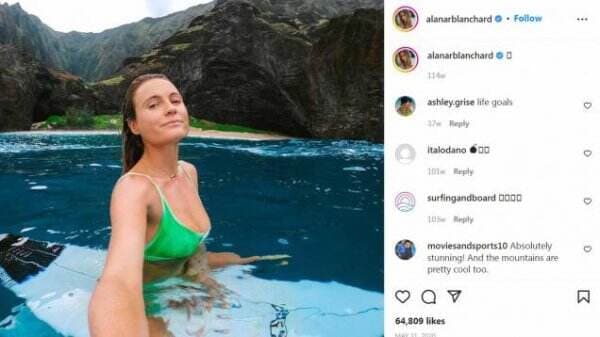 Punya Bikini Body Goals, Pesona Alana Blanchard sang Ratu Ombak yang Cantik Jelita