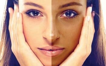 3 Ciri-ciri Kolesterol Tinggi Pada Mata, Nomor 1 Perlu Diwaspadai 3 Ciri-ciri Kolesterol Tinggi Pada Mata, Nomor 1 Perlu Diwaspadai