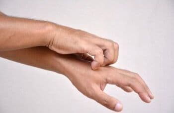 Mengenal Beda, Gejala dan Penularan Cacar Api Vs Cacar Air Mengenal Beda, Gejala dan Penularan Cacar Api Vs Cacar Air