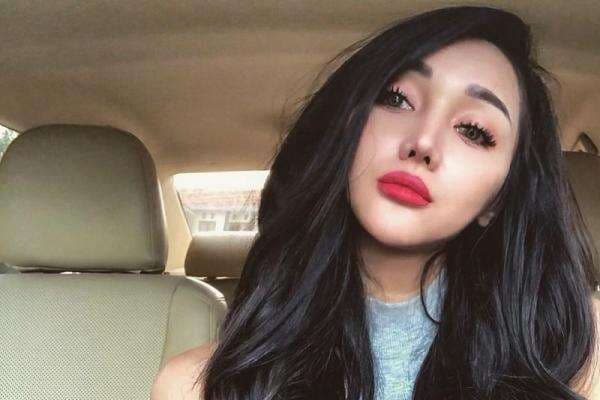 Lucinta Luna Ungkap Biaya Operasi, Sebut Harga Potong Jakun Paling Mahal Lucinta Luna Ungkap Biaya Operasi, Sebut Harga Potong Jakun Paling Mahal