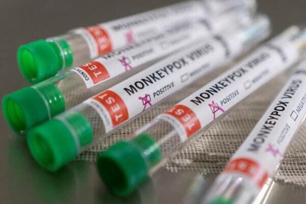 Stok Langka, Spanyol Setujui Vaksin Cacar Monyet Dosis Kecil