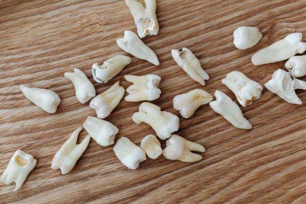 7 Arti Mimpi Gigi Atas Copot, dari Soal Rezeki hingga Ajal 7 Arti Mimpi Gigi Atas Copot, dari Soal Rezeki hingga Ajal