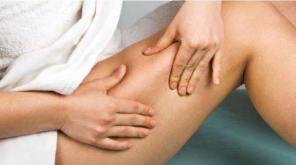 Mudah Dicari, Inilah Cara Menghilangkan Stretch Mark Secara Alami Mudah Dicari, Inilah Cara Menghilangkan Stretch Mark Secara Alami