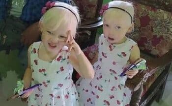 Kisah Anak Kembar Albino di Wonogiri Mirip Bule hingga Orang Tuanya Dikira Pembantu, Begini Kondisinya Saat Ini! Kisah Anak Kembar Albino di Wonogiri Mirip Bule hingga Orang Tuanya Dikira Pembantu, Begini Kondisinya Saat Ini!