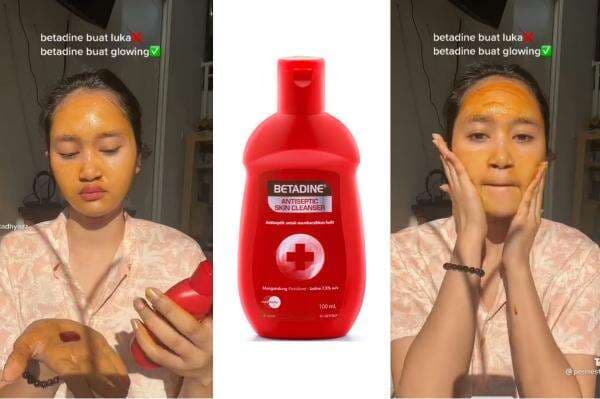 Viral di TikTok! Ini Kata Dokter tentang Tren Menggunakan Betadine di Wajah! Viral di TikTok! Ini Kata Dokter tentang Tren Menggunakan Betadine di Wajah!