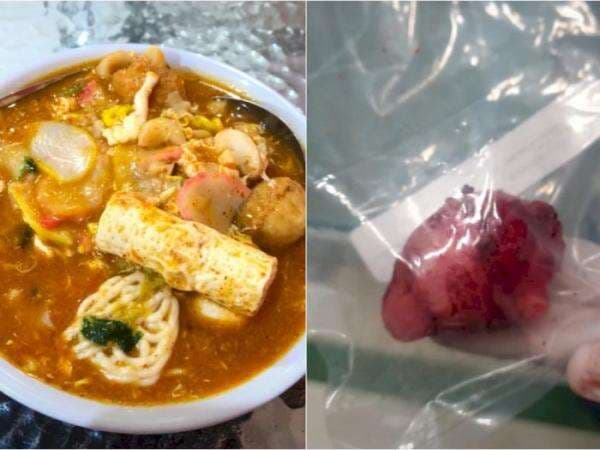 Viral Cewek Makan Seblak hingga Mie Ayam Hampir Setiap Hari, Berujung Operasi Tumor Viral Cewek Makan Seblak hingga Mie Ayam Hampir Setiap Hari, Berujung Operasi Tumor