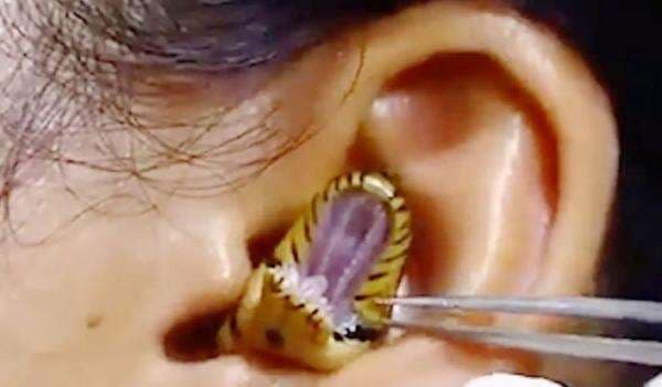 Viral, Seekor Ular Hidup Masuk ke dalam Telinga Wanita Viral, Seekor Ular Hidup Masuk ke dalam Telinga Wanita