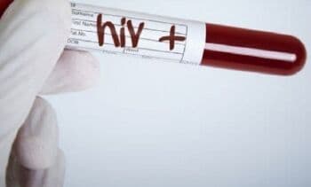 Apa Benar Pengidap HIV Pasti Kena AIDS?