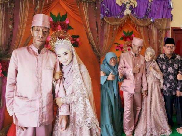 Kabar Bahagia! Surya Manurung Pria Pengidap Sindrom Langka Menikah, Istrinya Gadis Cantik Kabar Bahagia! Surya Manurung Pria Pengidap Sindrom Langka Menikah, Istrinya Gadis Cantik