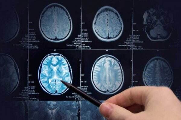 Kenali Tanda Kondisi Otak Lebih Tua atau Lebih Muda dari Usia Seharusnya