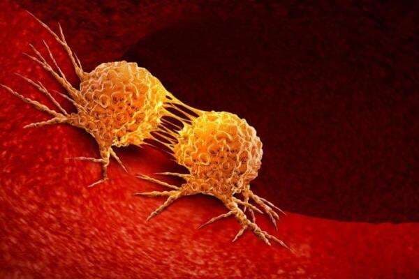 Apa Itu Karsinogenik, Kandungan Berbahaya dalam Obat dan Kosmetik, Bisa Sebabkan Kanker Apa Itu Karsinogenik, Kandungan Berbahaya dalam Obat dan Kosmetik, Bisa Sebabkan Kanker