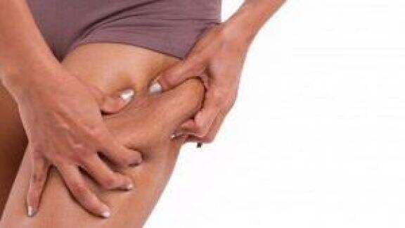 Gak Cuma Gegara Pubertas, Ini 5 Penyebab Stretch Mark Timbul di Payudara! Jangan Insecure Lagi Ya! Gak Cuma Gegara Pubertas, Ini 5 Penyebab Stretch Mark Timbul di Payudara! Jangan Insecure Lagi Ya!