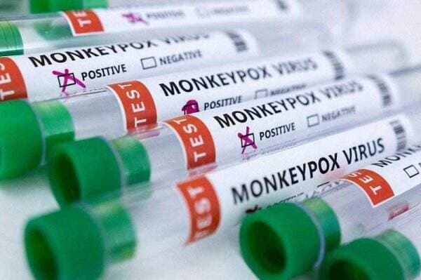 Cacar Monyet Bisa Berakibat Fatal pada Pengidap HIV atau Orang dengan Sistem Kekebalan Lemah