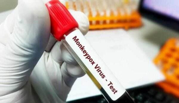 Peneliti Tiongkok Kembangkan Metode Rapid Test untuk Virus Cacar Monyet