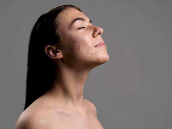 Imunitas Menurun Ternyata Bikin Kulit Sensitif, Ini Penjelasan Dermatologis Imunitas Menurun Ternyata Bikin Kulit Sensitif, Ini Penjelasan Dermatologis