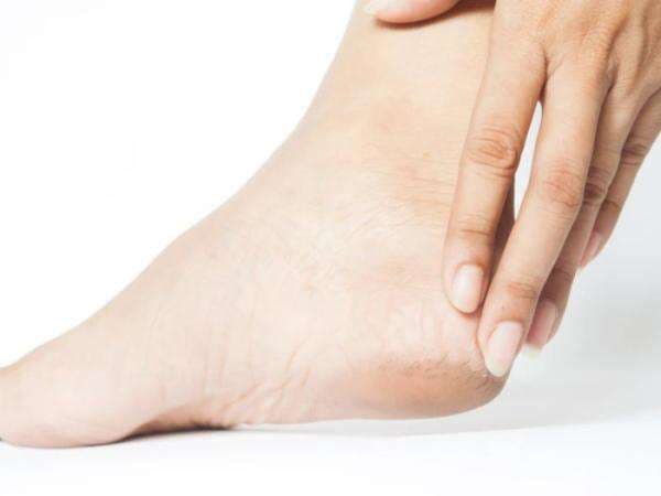 Ini 5 Tips Atasi Tumit Kaki yang Pecah-pecah, Tapi Simak Dulu Penyebabnya! Ini 5 Tips Atasi Tumit Kaki yang Pecah-pecah, Tapi Simak Dulu Penyebabnya!