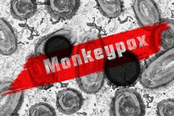 WHO Resmi Ganti Nama Penyakit Cacar Monyet Jadi Mpox