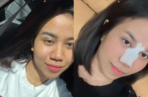 Tak Puas Operasi? Mayang Adik Vanessa Angel Bakal Potong Cuping Hidung, Ini Alasannya! Tak Puas Operasi? Mayang Adik Vanessa Angel Bakal Potong Cuping Hidung, Ini Alasannya!Â