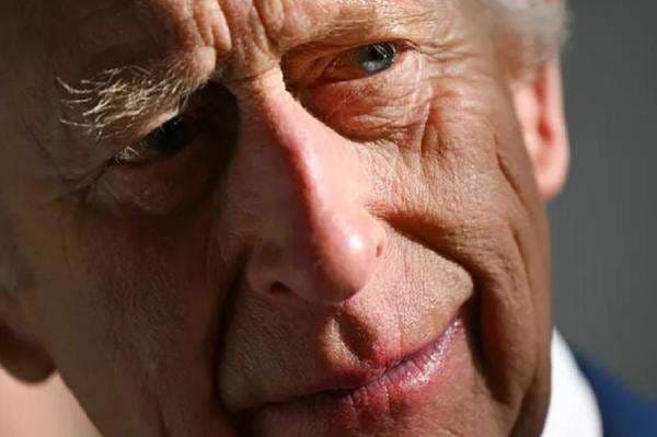 Raja Charles III Kalah Melawan Kanker, Penampilan Fisiknya Ditutupi Makeup Raja Charles III Kalah Melawan Kanker, Penampilan Fisiknya Ditutupi Makeup