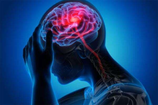Gejala, Penyebab, dan Pencegahan Stroke Iskemik, Penyakit yang Sebabkan Kematian Park Jin Ah Gejala, Penyebab, dan Pencegahan Stroke Iskemik, Penyakit yang Sebabkan Kematian Park Jin Ah