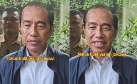 Warganet Resah: Mantan Presiden Joko Widodo Diduga Mengidap Sindrom Stevens Johnson Warganet Resah: Mantan Presiden Joko Widodo Diduga Mengidap Sindrom Stevens Johnson