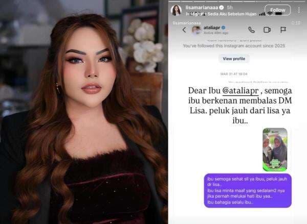 Lisa Mariana Minta Maaf pada Atalia Praratya, Isyaratkan Ada Wanita Lain di Sekitar RK Lisa Mariana Minta Maaf pada Atalia Praratya, Isyaratkan Ada Wanita Lain di Sekitar RK