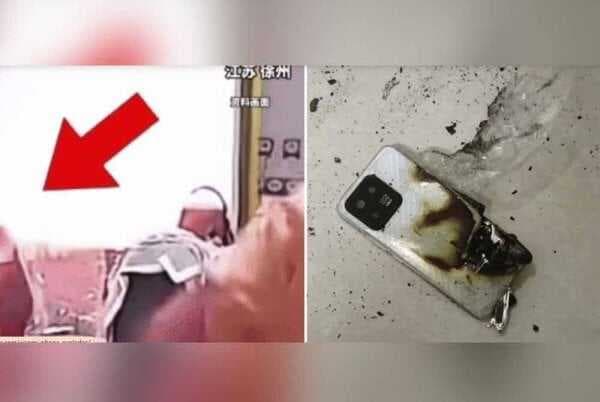 Bocah Tiga Tahun Terluka Akibat HP Meledak saat Menonton Video Bocah Tiga Tahun Terluka Akibat HP Meledak saat Menonton Video