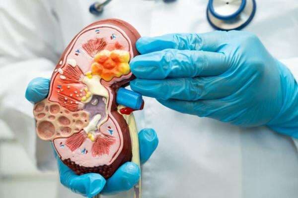 5 Gejala Batu Ginjal yang Terlihat saat Buang Air Kecil 5 Gejala Batu Ginjal yang Terlihat saat Buang Air Kecil