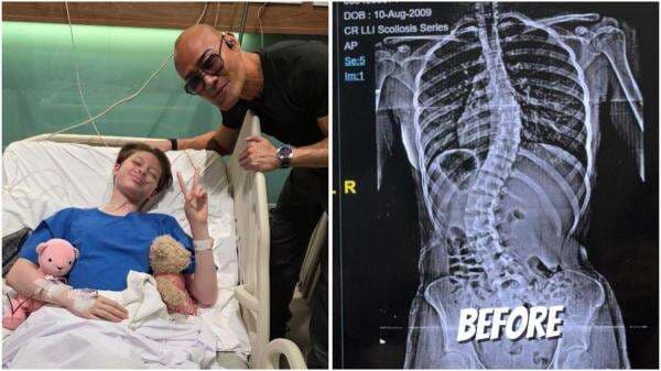 Nada Anak Deddy Corbuzier Jalani Operasi Skoliosis, 12 Hari Dirawat di RS Nada Anak Deddy Corbuzier Jalani Operasi Skoliosis, 12 Hari Dirawat di RS