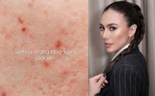 Wulan Guritno Tanggapi Komentar Julid Netizen yang Sebut Wajahnya Gradakan Wulan Guritno Tanggapi Komentar Julid Netizen yang Sebut Wajahnya Gradakan