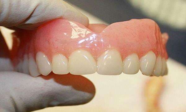 Begini Pengalaman Pasang Gigi Palsu Pakai BPJS, Prosedur dan Tipsnya Begini Pengalaman Pasang Gigi Palsu Pakai BPJS, Prosedur dan Tipsnya